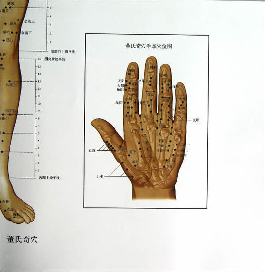 董氏奇穴与经穴对照挂图(1-3|王 敏 石金 芳|医药科技出版社》